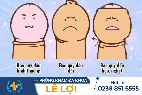 Nhận biết nam giới dài bao quy đầu
