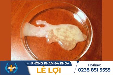 Cách hỗ trợ điều trị tinh trùng yếu hiệu quả cùng bác sĩ chuyên khoa giỏi