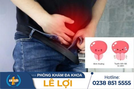 Viêm tuyến tiền liệt và những hiểm họa khôn lường