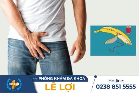 Bao quy đầu dài có ảnh hưởng gì không?