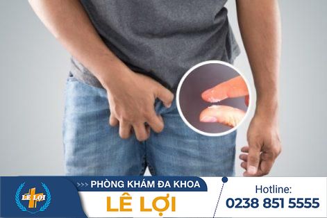 Bựa sinh dục ở dương vật có mùi hôi là do đâu?