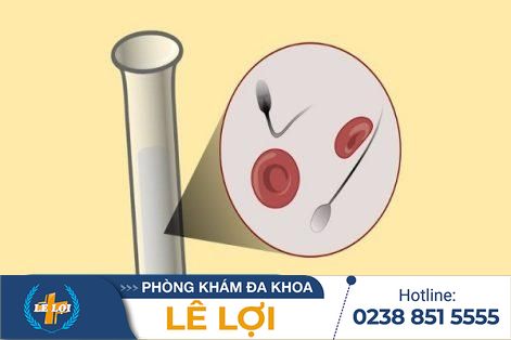 Cẩn Trọng Khi Xuất Tinh Ra Máu – Dấu Hiệu Cơ Thể Đang Báo Động