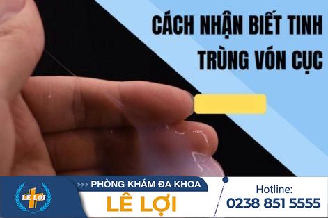 Tinh trùng vón cục – Dấu hiệu nghiêm trọng không nên chủ quan