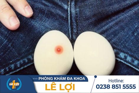 Tinh hoàn nổi mụn là triệu chứng bệnh gì?