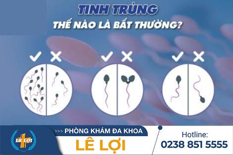 Tinh trùng bất thường là như thế nào?