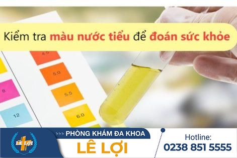 Màu sắc nước tiểu nói lên bệnh gì?
