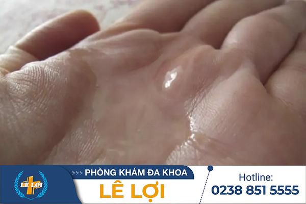 Tinh trùng loãng ở nam giới – Những điều quý ông cần biết