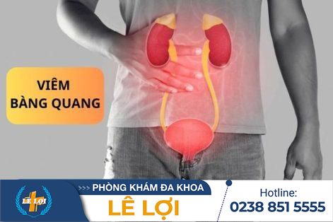 Viêm bàng quang là bệnh gì – điều trị hiệu quả tại Phòng khám Lê Lợi