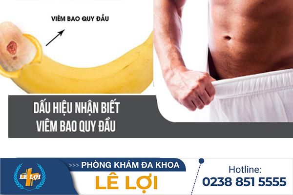 Chữa Trị Viêm Bao Quy Đầu Hiệu Quả Tại Phòng Khám Nam Khoa Lê Lợi