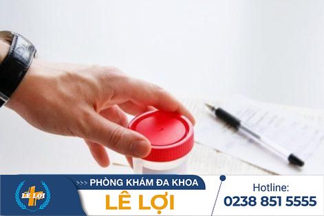 Xét nghiệm tinh trùng chính xác tại đâu – Phòng khám nam khoa Lê Lợi uy tín