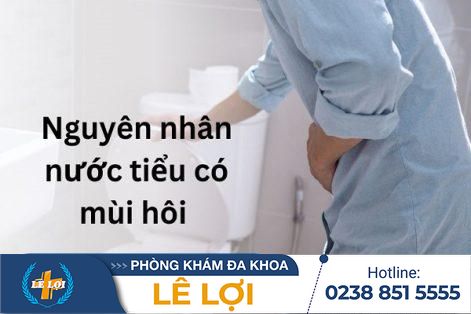 Nước tiểu có mùi hôi là bị bệnh gì?