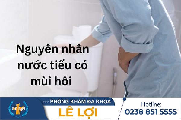 Nước tiểu có mùi hôi là bị bệnh gì?