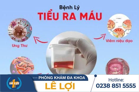 Nguy hiểm của tiểu ra máu mà nam giới cần đặc biệt lưu ý