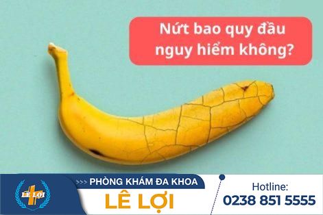 Nứt bao quy đầu nguy hiểm không?