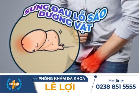 Tìm hiểu về hiện tượng sưng lỗ sáo ở nam giới