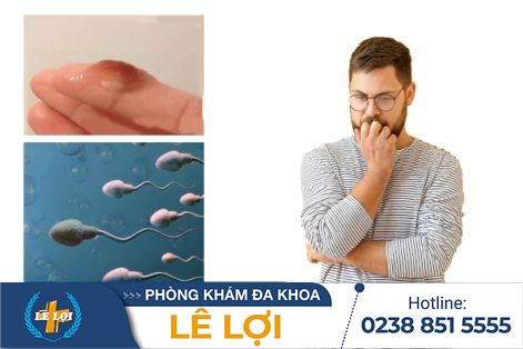 Tinh dịch có màu nâu là bị bệnh gì?