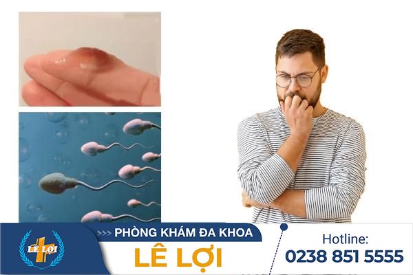 Tinh dịch có màu nâu là bị bệnh gì?
