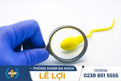 Cách nhận biết tinh dịch có màu vàng