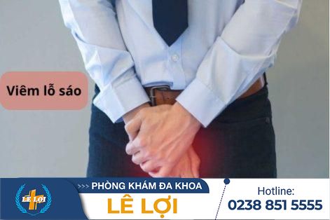 Điều trị viêm lỗ sáo ở đâu?