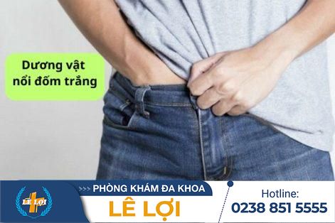 Dương vật nổi đốm trắng và những nguyên nhân bệnh lý