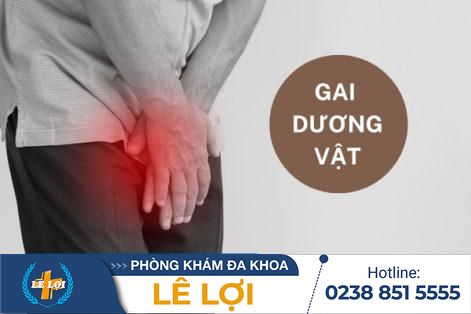 Làm thế nào để nhận biết gai dương vật?