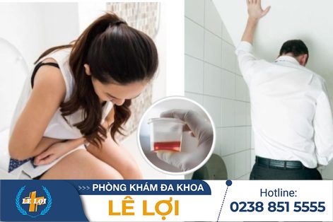 Tiểu buốt ra máu nguy hiểm hay không?