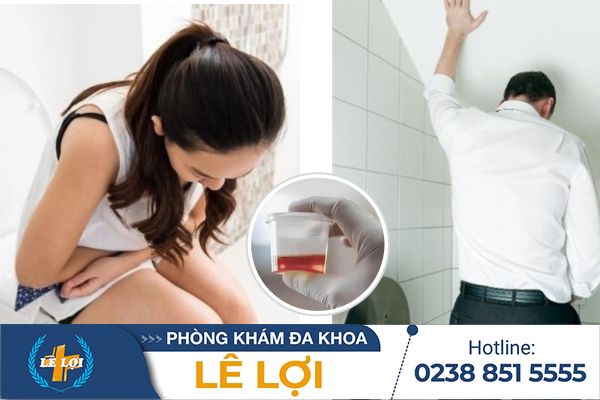 Tiểu buốt ra máu nguy hiểm hay không?