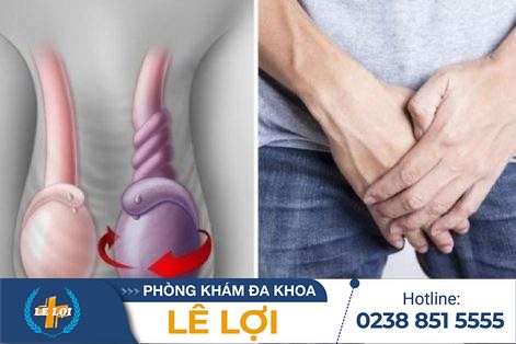 Chủ quan với bệnh tinh hoàn: Nhiều người lãnh hậu quả!