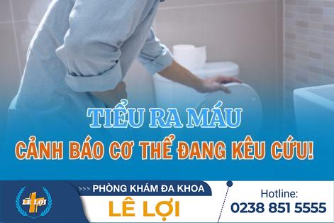 Đi tiểu buốt ra máu – Cảnh báo cơ thể đang “kêu cứu”