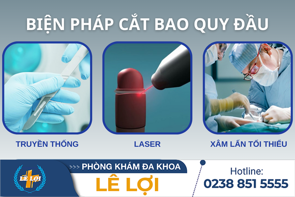 Cách chữa dài bao quy đầu an toàn và nhanh chóng cho nam giới
